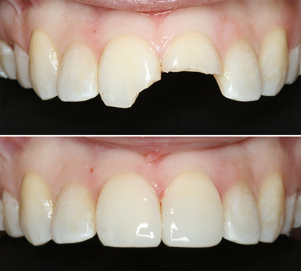 Jessica Before After