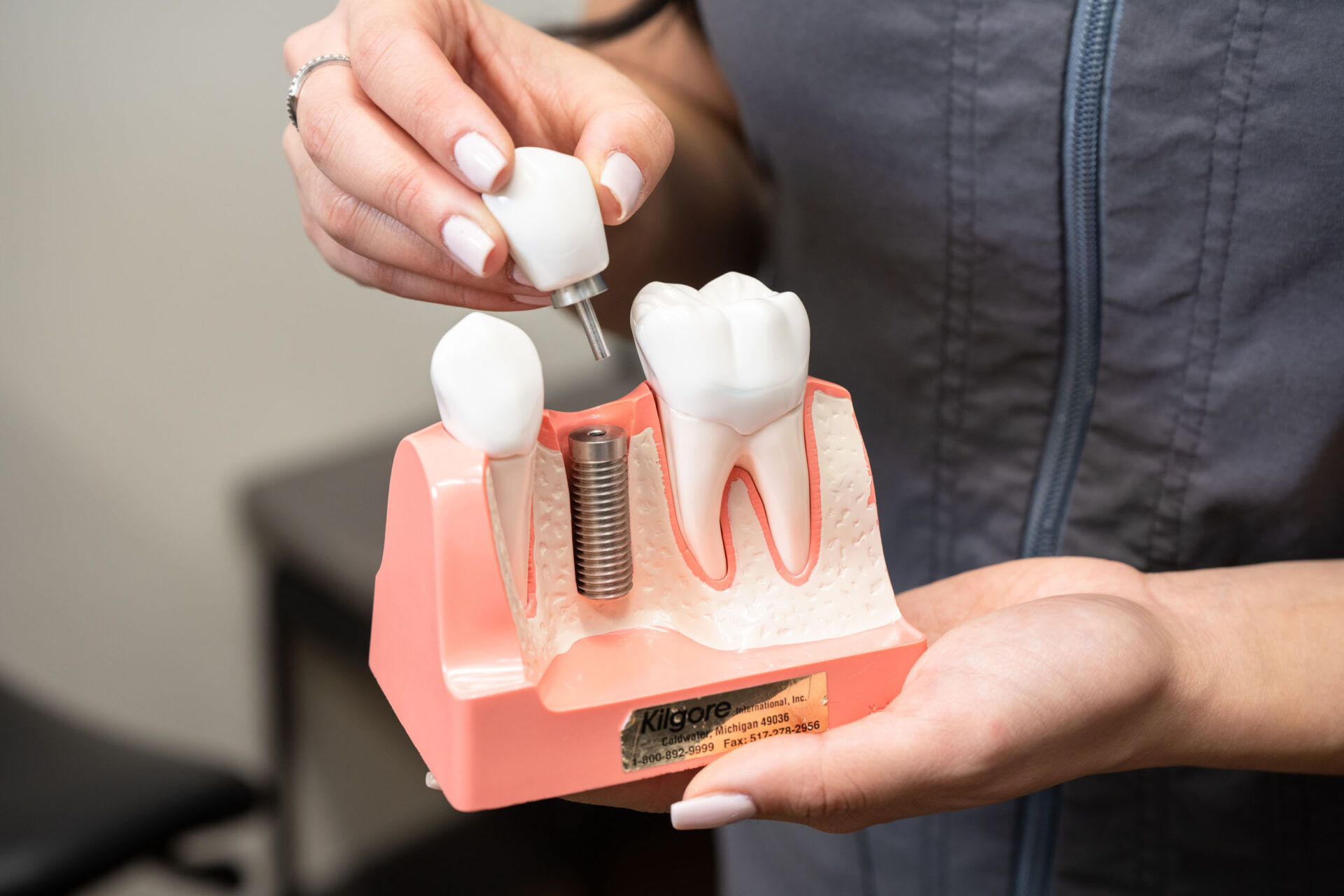Dental Implants Kensington Square Dental