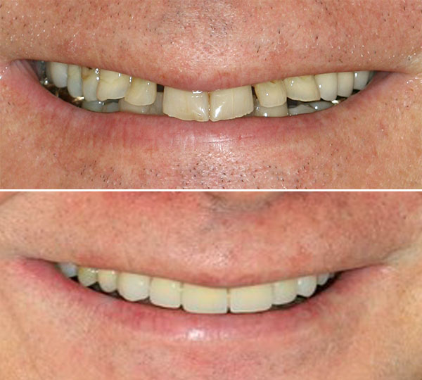 Patrick Before After